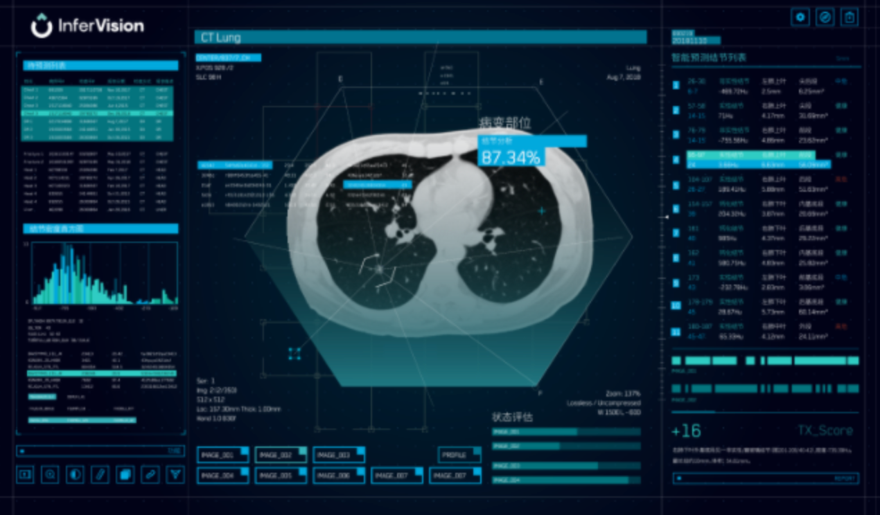 推想医疗 InferRead CT Lung-01.png